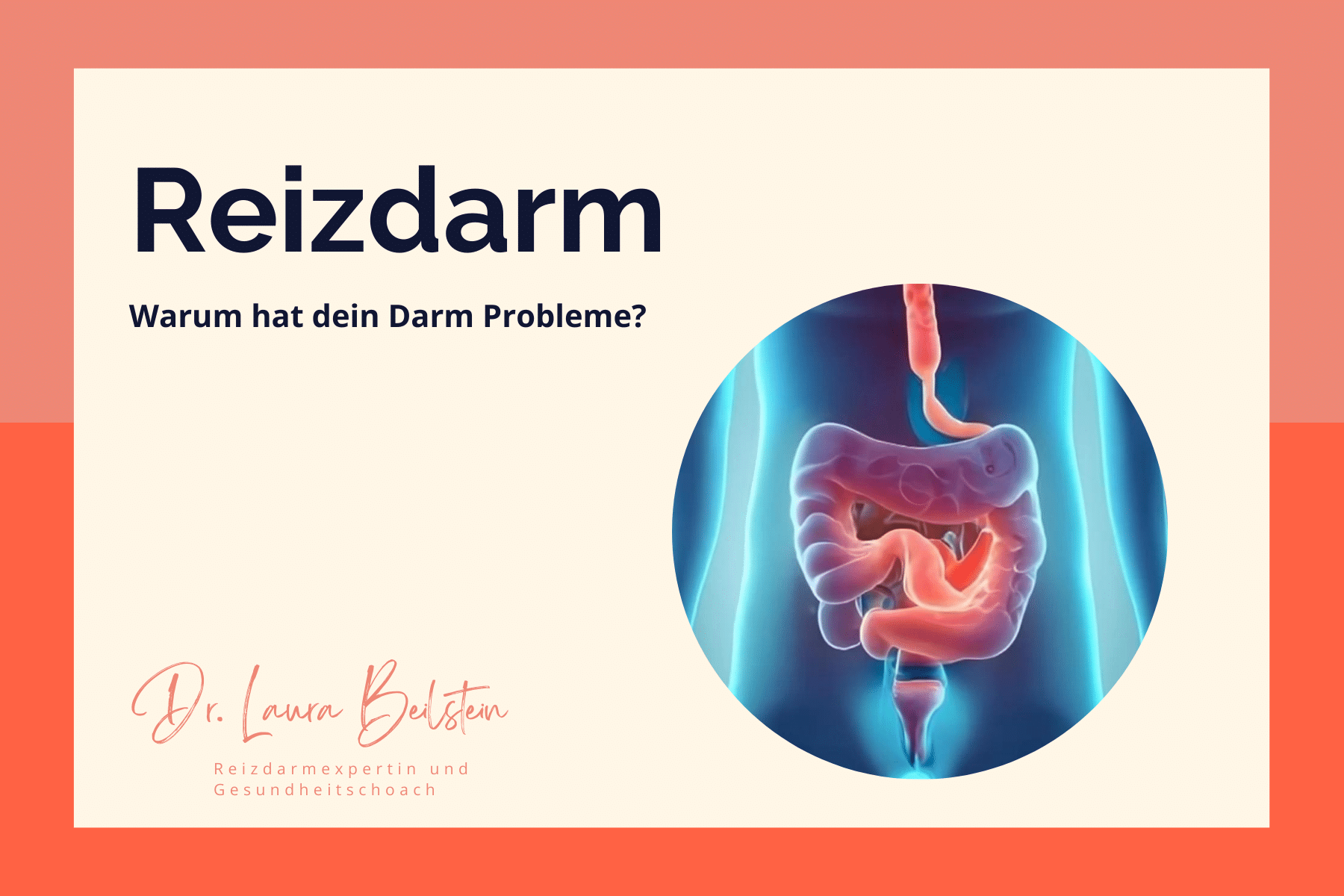 Sie betrachten gerade 4 Ursachen, warum du mit Reizdarmsymptomen zu kämpfen hast.